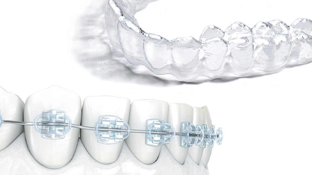 装置の選択肢